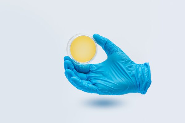 Blue gloved hand holding a 65mm Surface/Contact Plates – Tryptic Soy Agar (TSA).